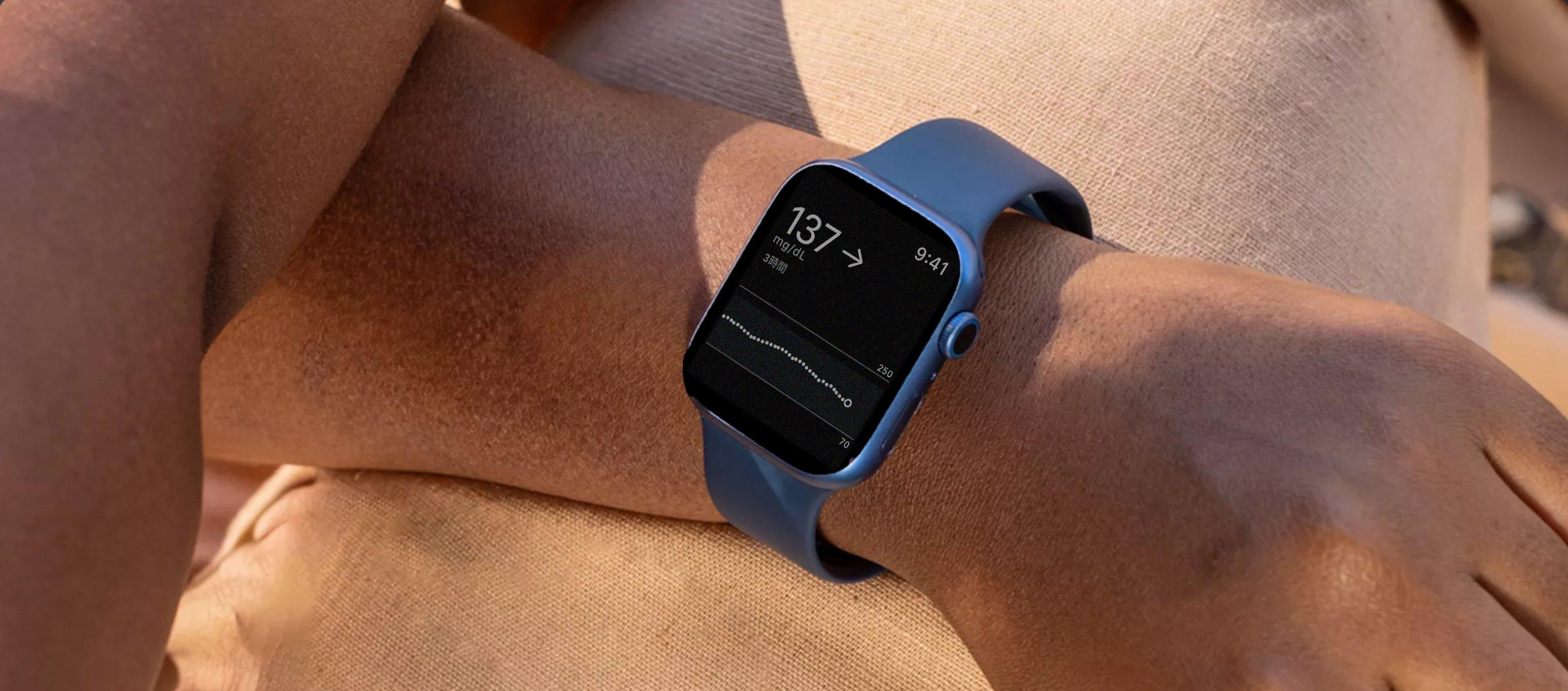 Apple Watchの写真