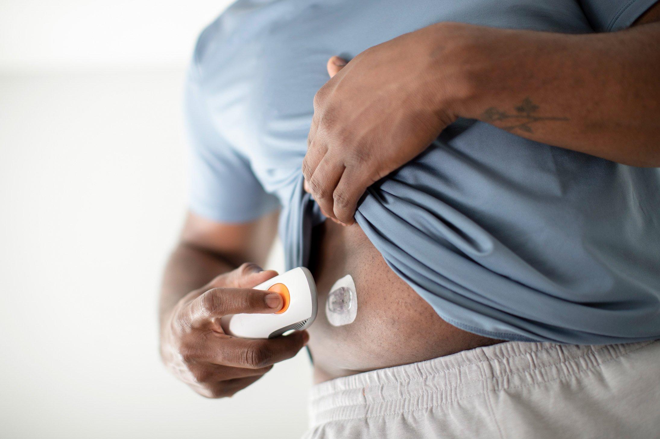 Teenager beim Anbringen des Dexcom G7-Sensors mit dem Applikator