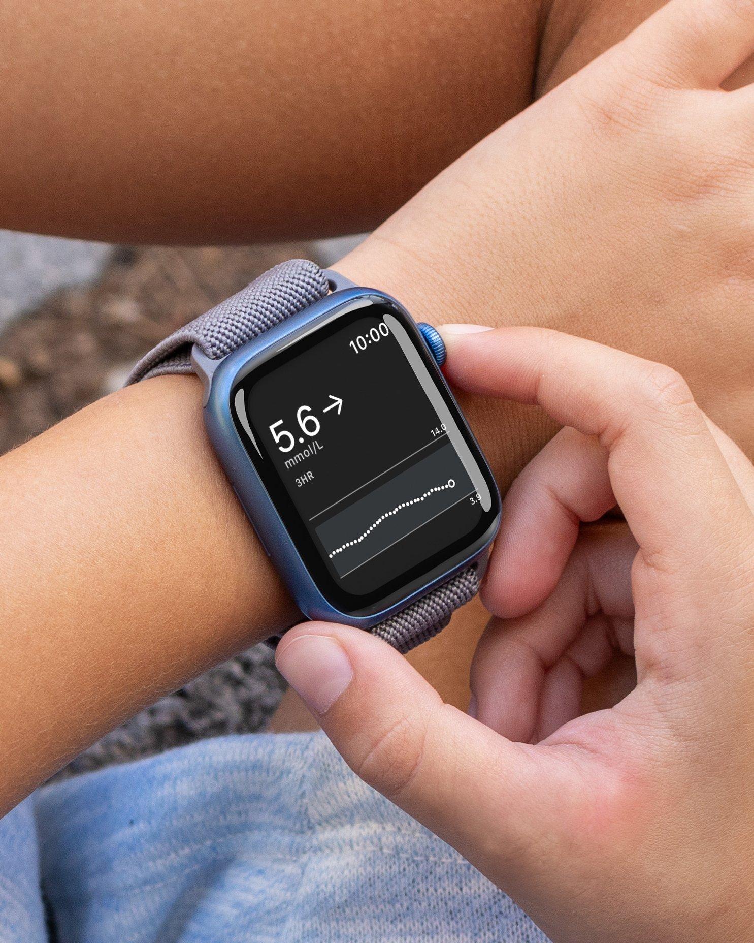 dexcom-g7-direct-to-watch