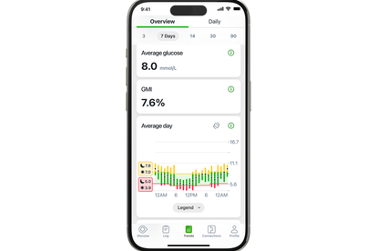 Dexcom G7 application showing the overview tab