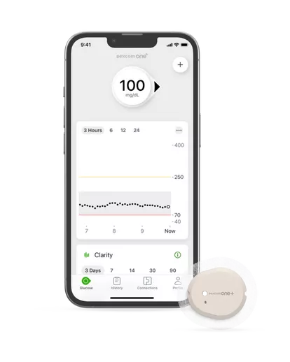 هاتف ذكي يعرض شاشة تطبيق Dexcom ONE+