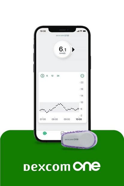 Dexcom ONE and smart device