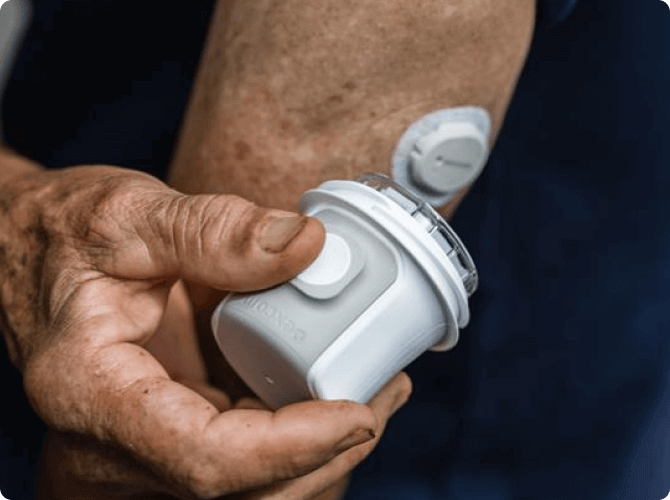 Person applying the Dexcom G7 15 Day sensor