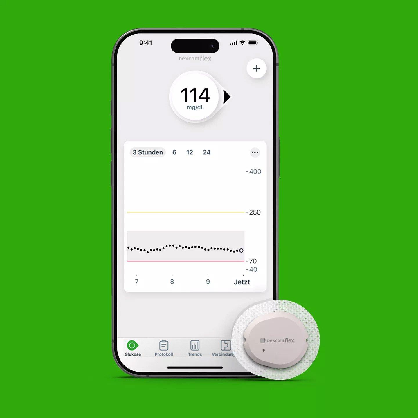 Kompatibilität - mit welchen Handys du deinen Dexcom Flex verbinden kannst 