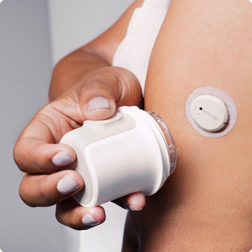 Nekdo si namešča napravo Dexcom G7 na zadnji del roke