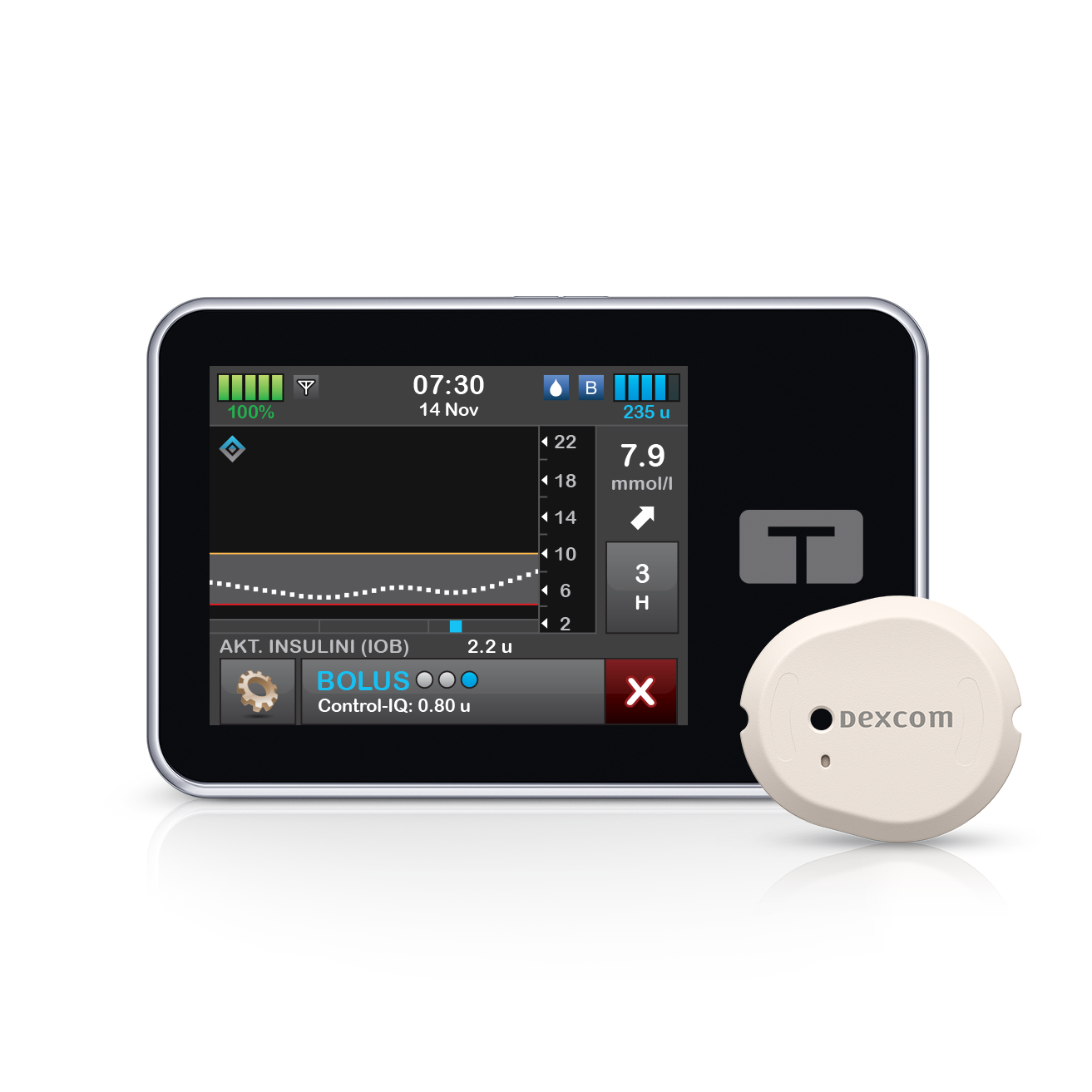 Dexcom CGM systems with the Tandem T:Slim