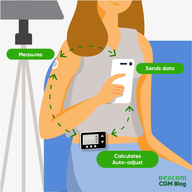 An automated insulin delivery system works with a glucose sensor measuring data which sends data to the phone and insulin pump, the inulin pump then derives a bolus amount based on a proprietary algorithm and administers insulin to the user to manage their glucose levels effectively.  