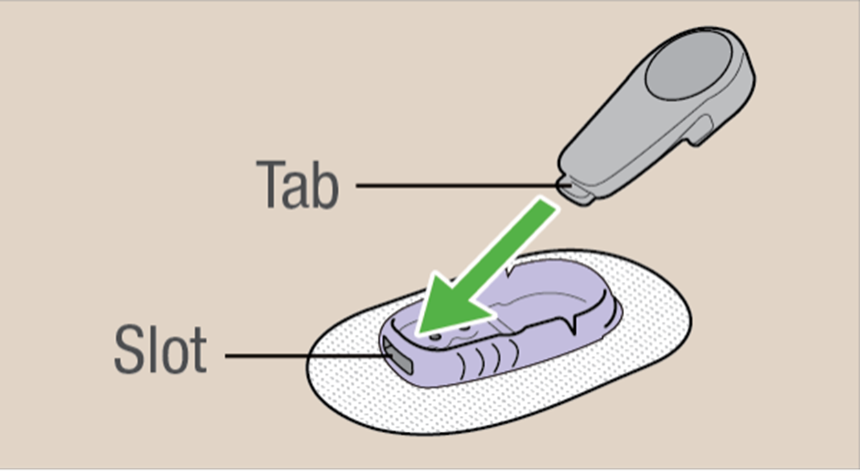 Dexcom G6 Transmitter