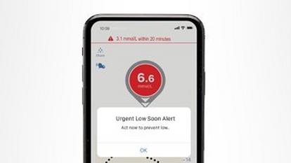 Predictive Alert to prevent low with the Dexcom G6 CGM system