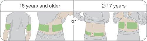 https://cdn.media.amplience.net/i/dexcom/en-ca-g6-sensor-placement-illustration?qlt=default&fmt=auto