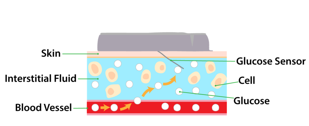 How does Dexcom g6 work?