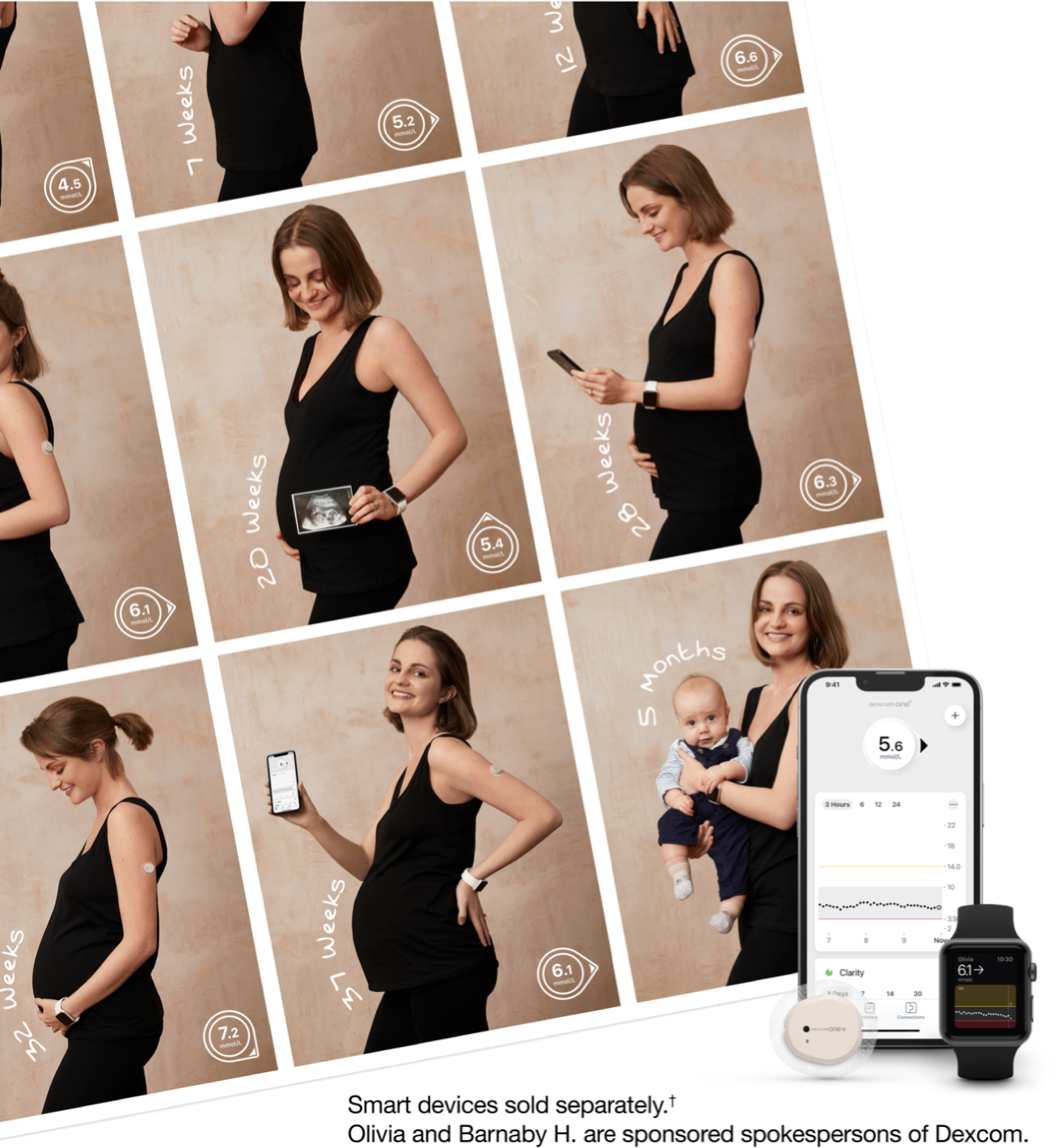 A woman uses Dexcom CGM during pregnancy