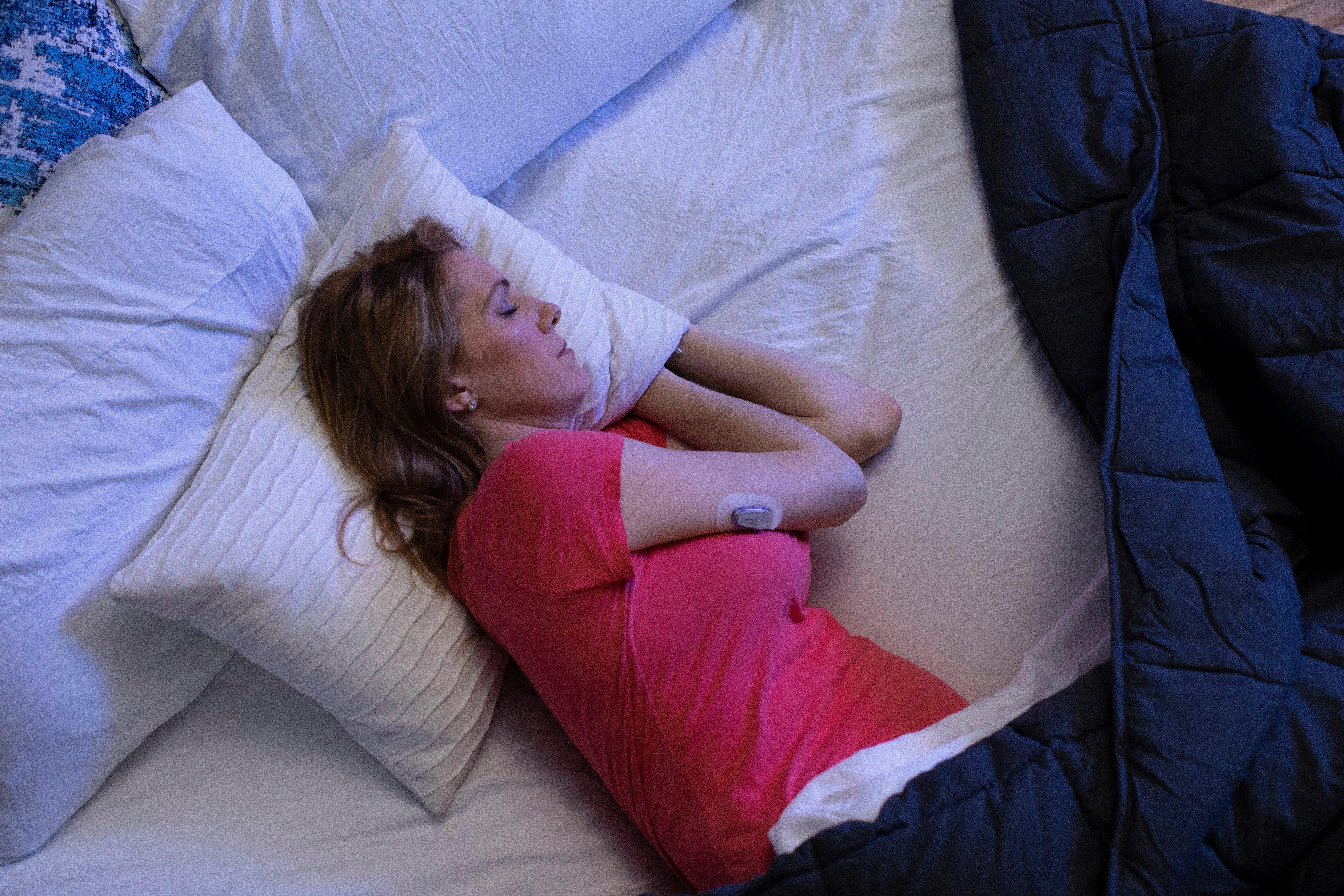 A woman sleeping while wearing the Dexcom sensor