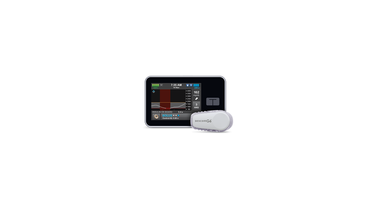 Dexcom G6 CGM integrates with Tandem t:slim X2