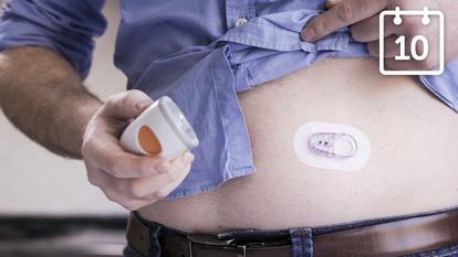 Man attaching Dexcom device to his belly