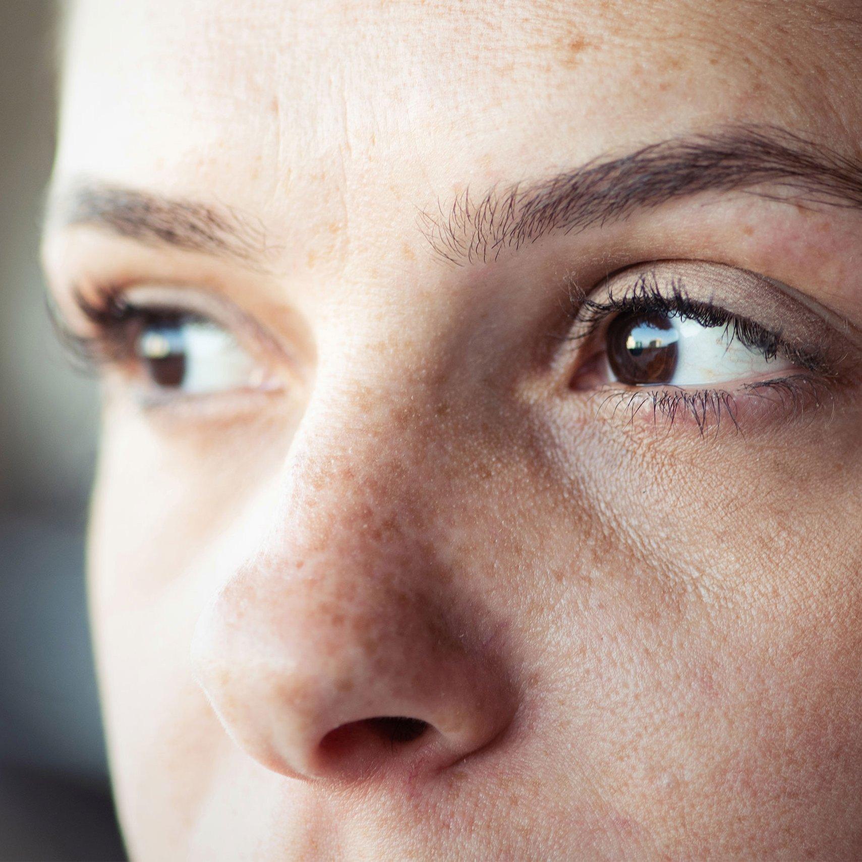 Woman with diabetic retinopathy