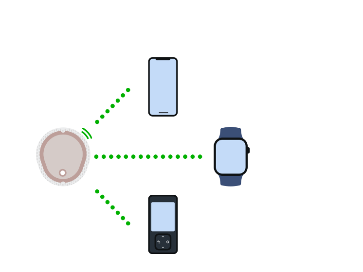 l'unico CGM da visualizzare contemporaneamente su smartwatch e telefono