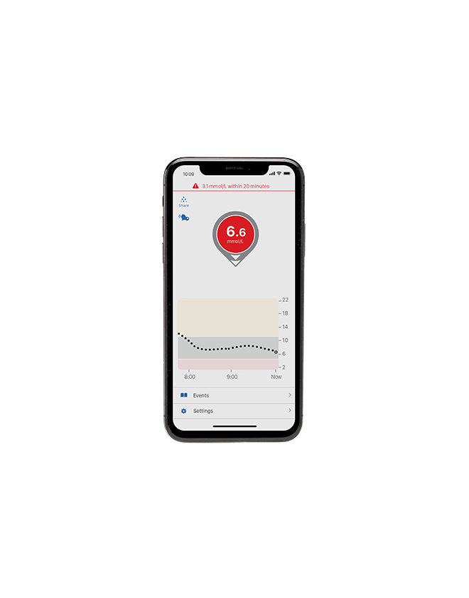 Dexcom G6 CGM alerts provide a 20 minute advance warning