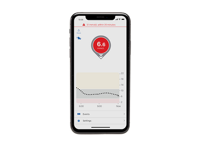 Dexcom G6 CGM alerts provide a 20 minute advance warning