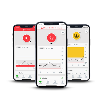 Alerts and alarms on Dexcom G7