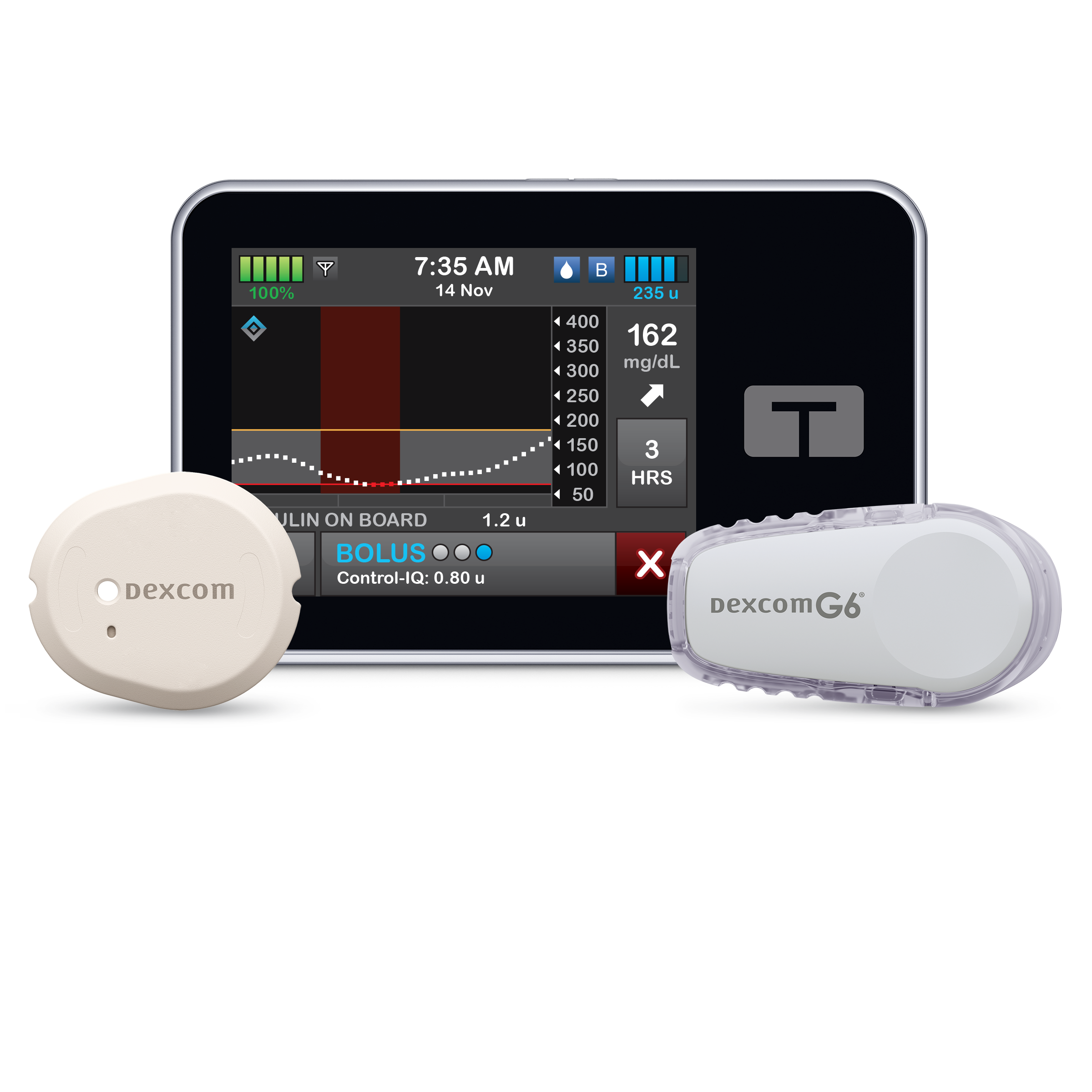Dexcom CGM systems with the Tandem T:Slim