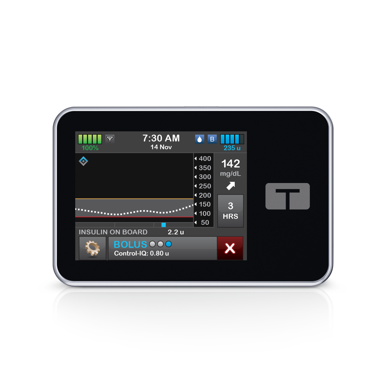 ​​​Automatic correction bolus 