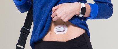 Dexcom G6 diabetes sensor can be worn on abdomen
