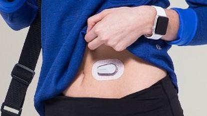 A person with a Dexcom G6 diabetes sensor on their stomach