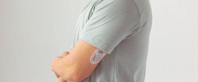 Rückseite des Oberarms