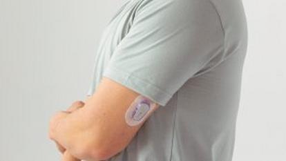 A person with a Dexcom G6 diabetes sensor on their upper arm