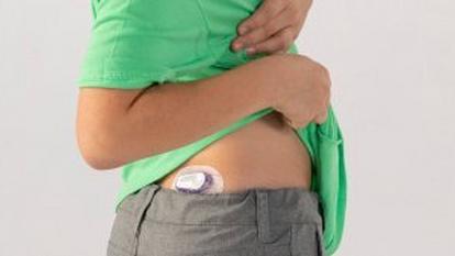 A person with a Dexcom G6 diabetes sensor on the upper part of the buttocks