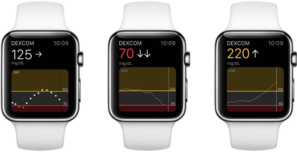 Puedo ver los datos del sistema de monitorización continua de glucosa (MCG)  Dexcom G6 en un Apple Watch?