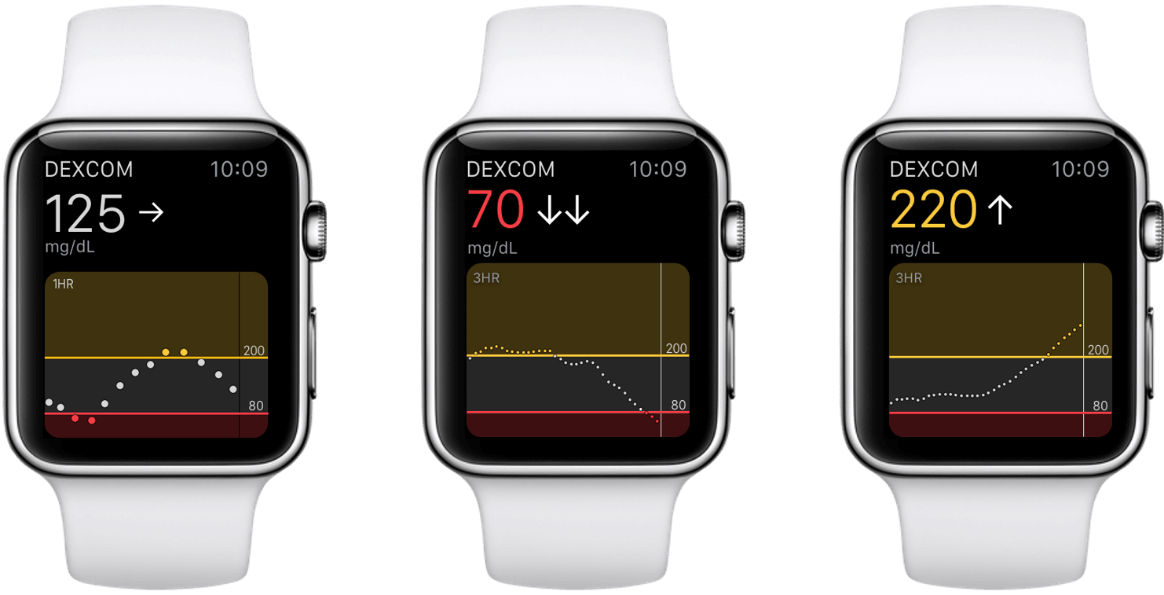 Can I view my Dexcom G6 Continuous Glucose Monitoring CGM System