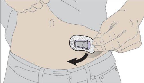 Dexcom G6 sensor - 1 individual sensor - NEW unexpired – GaryT