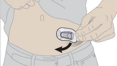 person removing sensor from abdomen