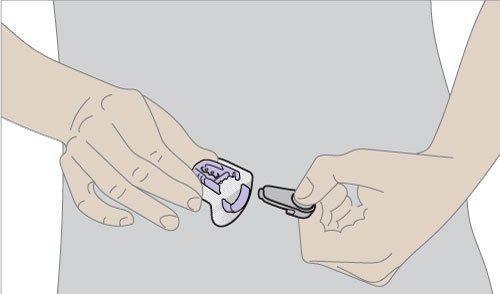 Removing a G6 transmitter without damaging the sensor