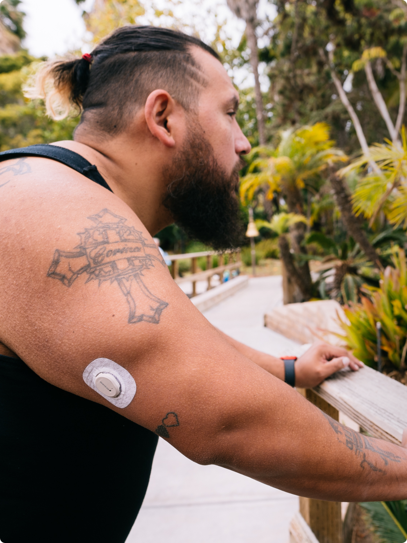 man wearing dexcom g7 sensor back of arm