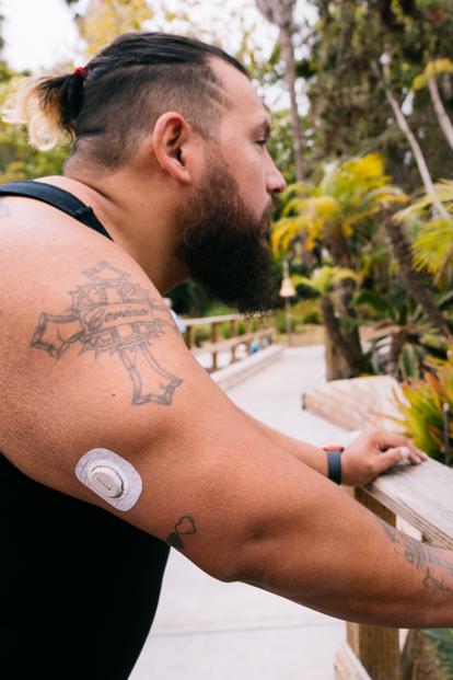 man wearing dexcom g7 sensor back of arm