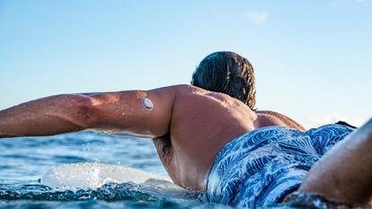 Surfer using Dexcom and Garmin to monitor his Glucose [video]