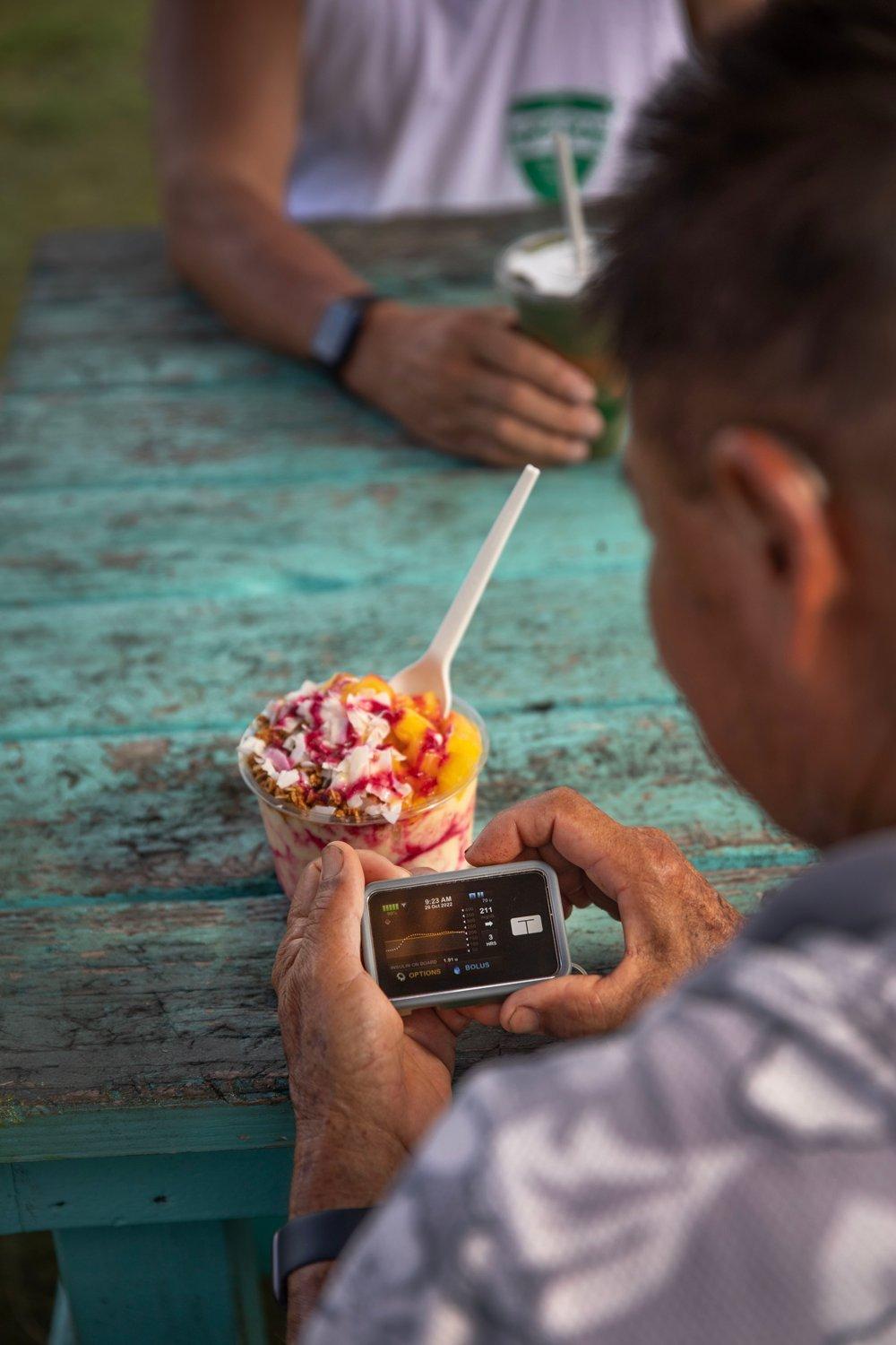 Man holding Tandem insulin pump