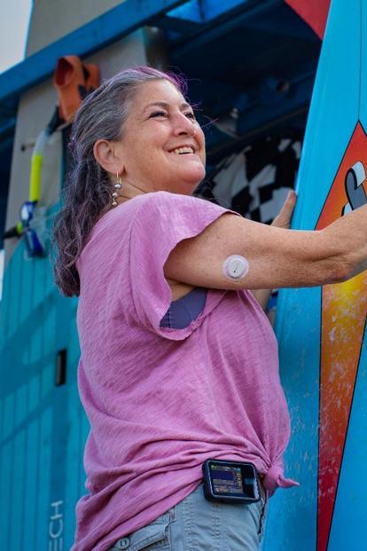 Woman smiling and wearing Dexcom G7 on back of upper arm and Tandem tslim insulin pump