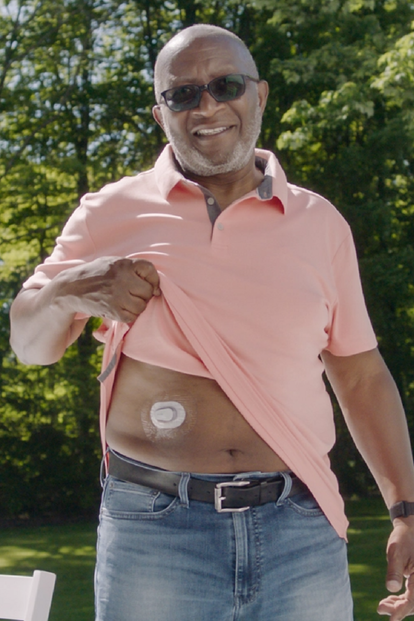 Man wearing Dexcom G6 CGM on his abdomen
