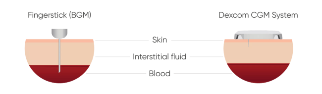 BGM vs CGM Diagram