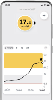 How do I set up and use Dexcom ONE+ alerts? | Dexcom