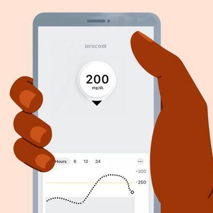 Ilustración de una mano sosteniendo un smartphone con información de Dexcom en pantalla