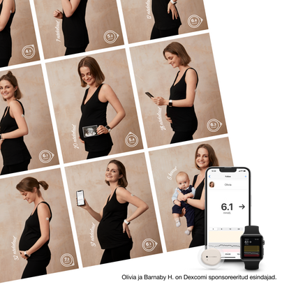 Naine kasutab Dexcom CGMi raseduse ajal