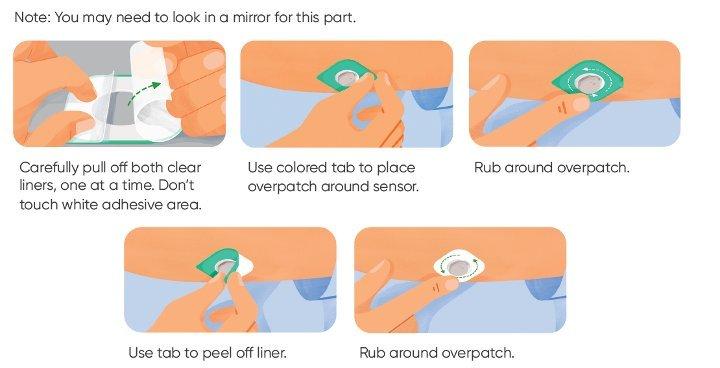 how-to-insert-your-dexcom-g7-sensor-dexcom