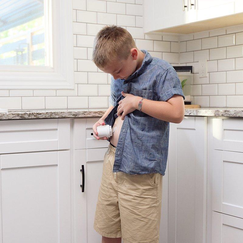 Dexcom teen warrior applying the Dexcom G7