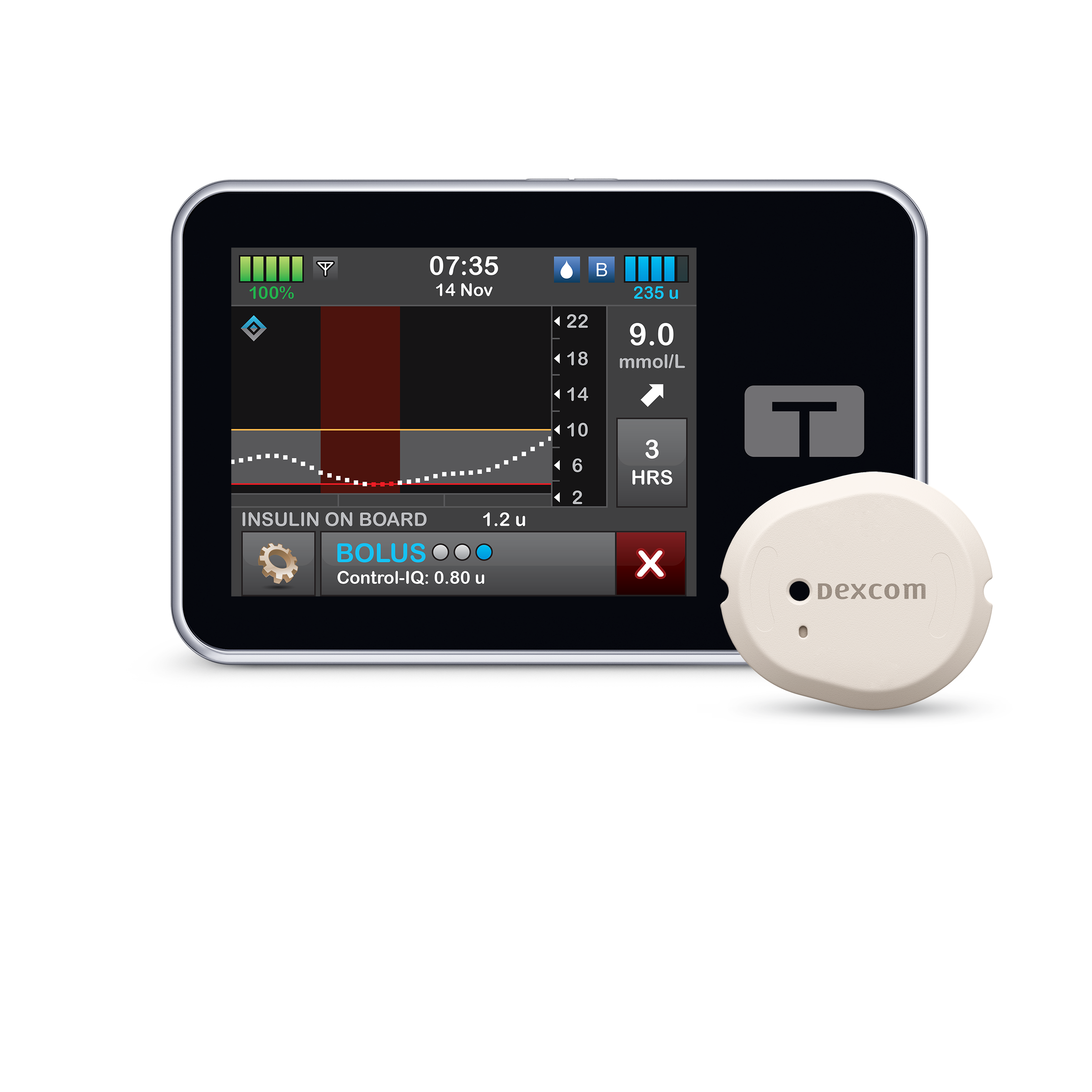 t:slim X2 with Dexcom sensor