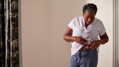Frau überprüft Dexcom ONE+ Sensor auf ihrem Bauch